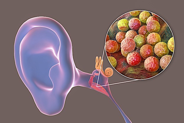 Mittelohrentzündung / Otitis media