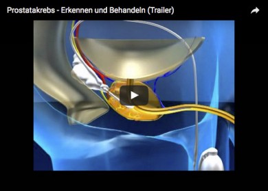 Prostatakrebs - Erkennen und Behandeln - ©AVISOmedienarbeit