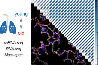 Multi-omics Analyse der Lungenalterung - ©Helmholtz Zentrum München