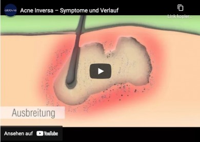 AbbVie Deutschland