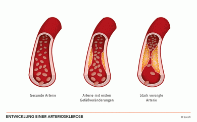 ©Sanofi Deutschland GMbH